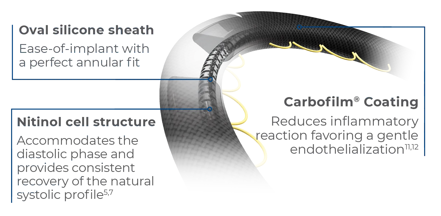 Memo 4D mitral valve repair ring three layer structure: silicone sheath, nitinol cell structure and Carbofilm coating