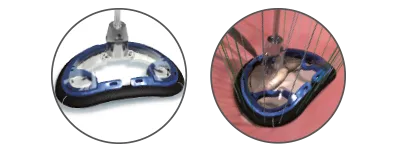 Memo 4D mitral valve repair holder